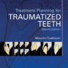 Treatment Planning For Traumatized Teeth Second Edition