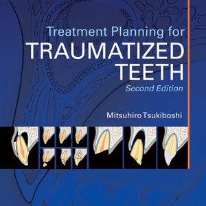 Treatment Planning For Traumatized Teeth Second Edition