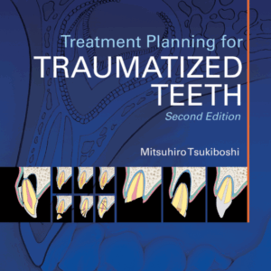 Treatment Planning For Traumatized Teeth Second Edition