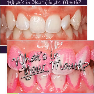 What’s in Your Mouth? What’s in Your Child’s Mouth?