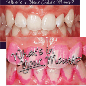 What’s in Your Mouth? What’s in Your Child’s Mouth?