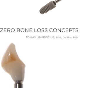 Zero Bone Loss Concepts