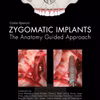 Zygomatic Implants- The Anatomy Guided Approach