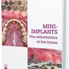 Mini-Implants: The Orthodontics Of The Future