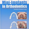Mini-Implants In Orthodontics: Innovative Anchorage Concepts