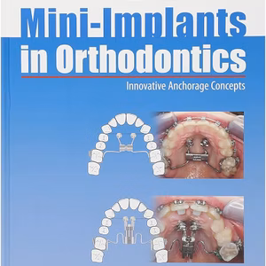Mini-Implants In Orthodontics: Innovative Anchorage Concepts