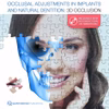 Occlusal Adjustments In Implants And Natural Dentition: 3D Occlusion
