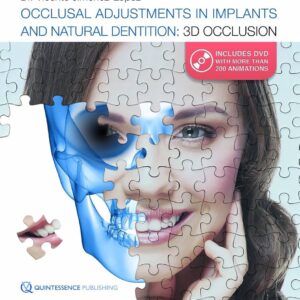 Occlusal Adjustments In Implants And Natural Dentition: 3D Occlusion
