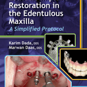 Esthetic Implant Restoration In The Edentulous Maxilla: A Simplified Protocol