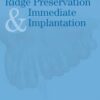 Ridge Preservation And Immediate Implantation
