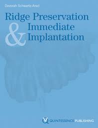 Ridge Preservation And Immediate Implantation