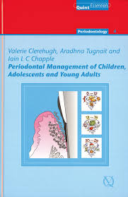 Periodontal Management Of Children