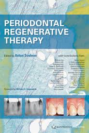 Periodontal Regenerative Therapy