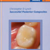Successful Posterior Composites