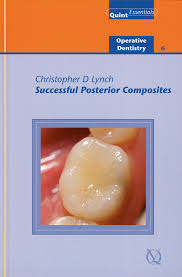 Successful Posterior Composites