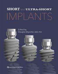 Short And Ultra-Short Implants