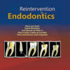 Reintervention In Endodontics