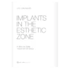 Implants In The Esthetic Zone: A Step By Step Treatment