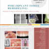 Peri-Implant Tissue Remodeling: Scientific Background And Clinical Implications