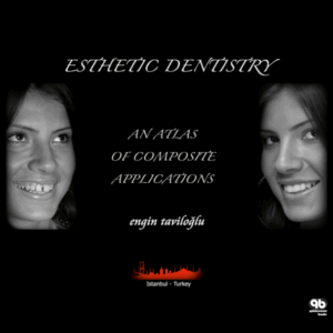 Esthetic Dentistry: An Atlas Of Composite Applications