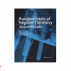 Fundamentals Of Implant Dentistry: Surgical Principles (Volume Ii)