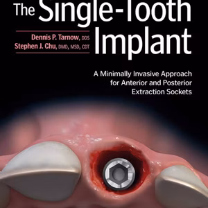 The Single-Tooth Implant: A Minimally Invasive Approach for Anterior and Posterior Extraction Sockets