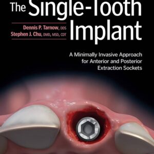 The Single-Tooth Implant: A Minimally Invasive Approach for Anterior and Posterior Extraction Sockets