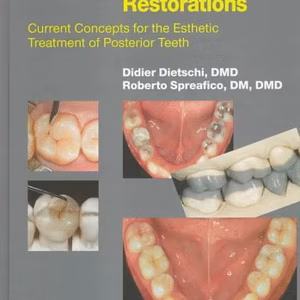 Adhesive Metal-Free Restorations