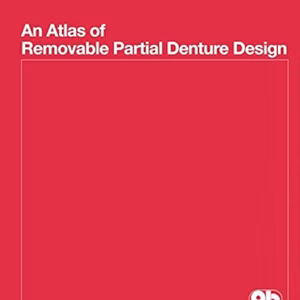 Atlas Of Removable Partial Denture Des
