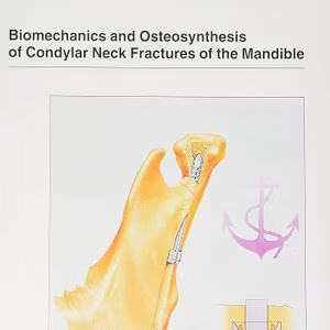 Biomechanics/Osteosynthesis Condylar