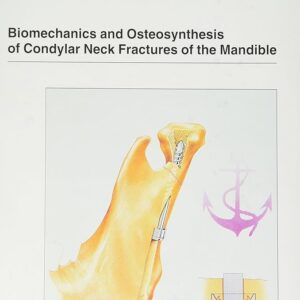 Biomechanics/Osteosynthesis Condylar