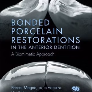 Bonded Porcelain Restorations Anterior Reg