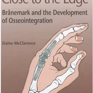 Close To The Edge - Branemark & Dev Osseo