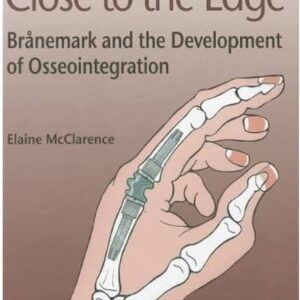 Close To The Edge - Branemark & Dev Osseo