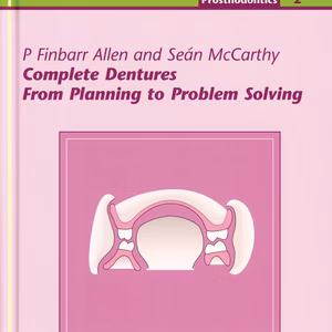 Complete Dentures Volume 2: From Plan To Prob Solving