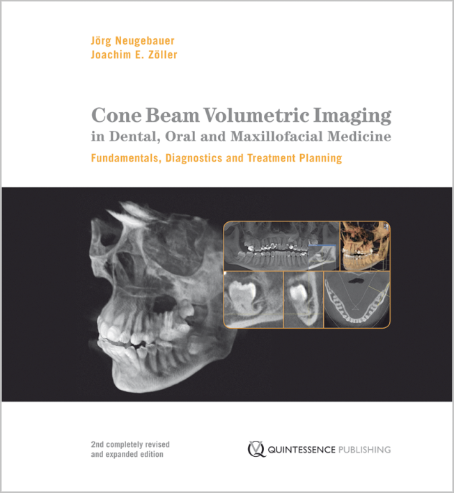 Cone Beam Volumetric Imaging In Dental, Oral And Maxillofacial Medicine