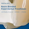 Resin-Bonded Fixed Dental ProsthesesResin-BondedFixed Dental Prostheses