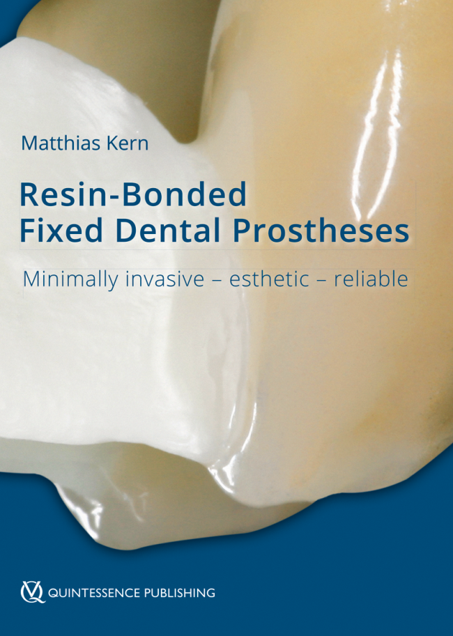 Resin-Bonded Fixed Dental ProsthesesResin-BondedFixed Dental Prostheses